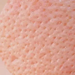 Uneven Skin Texture
